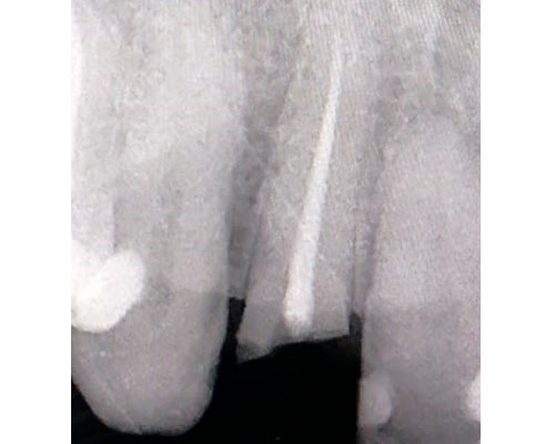 cirugia-oral_02b
